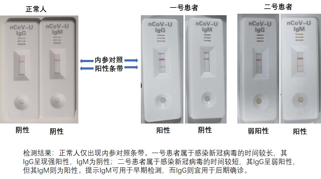 革新性检测技术引领时代潮流，最新试纸问世！